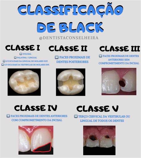 Classificação De Black