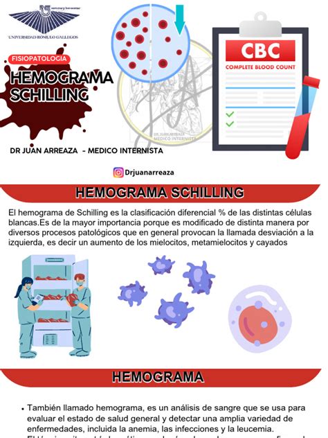 Classificação De Schilling