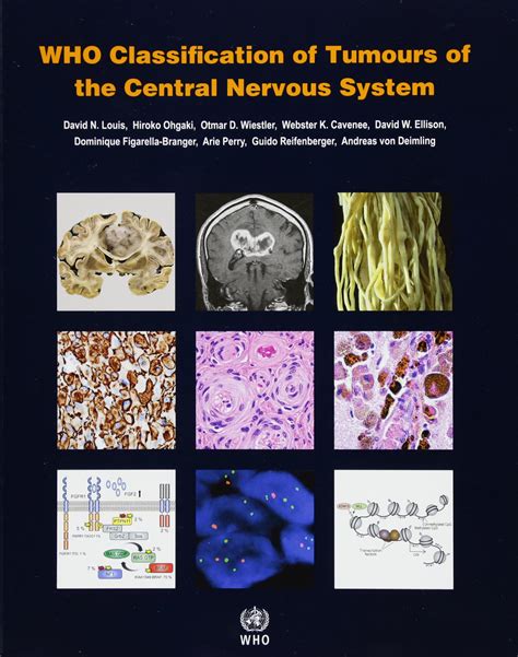 Classification Tumours Central Nervous System