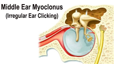 clicking in my ear when i chew