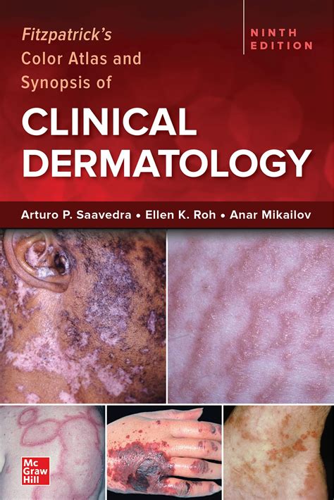clinical dermatology