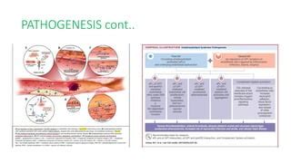 Clinical Features Pathogenesis Computed
