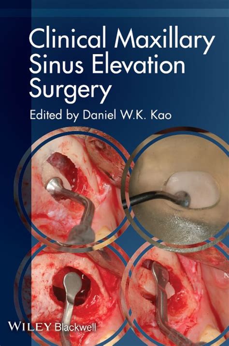 clinical maxillary sinus elevation surgery
