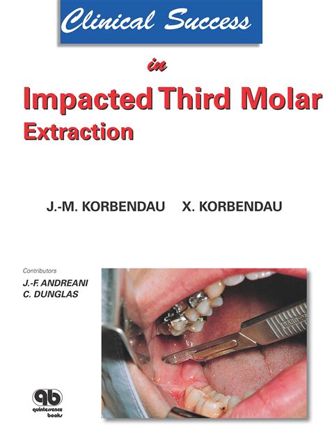 Clinical Success In Impacted Third Molar Extraction