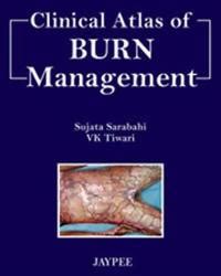 Read Clinical Atlas Of Burn Management By Sarabahi Sujata 