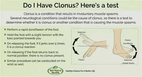 Clonus Vs Rigidity