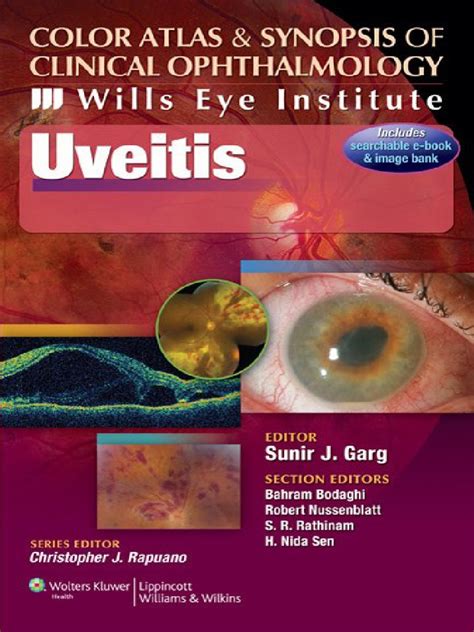 Full Download Color Atlas And Synopsis Of Clinical Ophthalmology Wills Eye Institute Uveitis Author Sunir J Garg Published On October 2011 