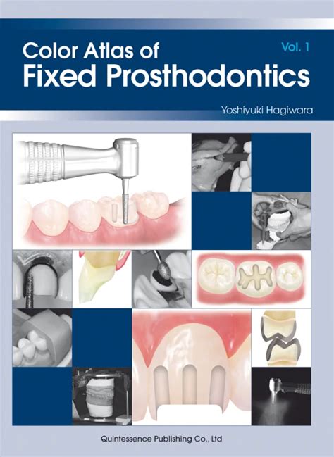 Full Download Color Atlas Of Fixed Prosthodontics 