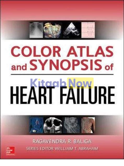 Read Online Color Atlas Of Heart Failure 