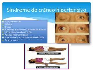 coma hipertensivo