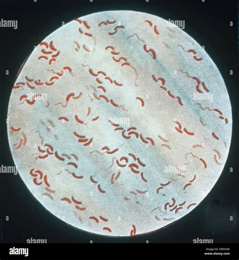 Comma Shaped Bacteria