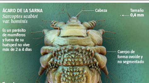 como es la sarna