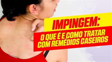 Como Matar Impinge
