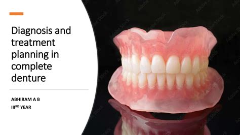 Complete Dentures From Planning To Problem Solving Prosthodontics 2 Quintessentials Of Dental Practice