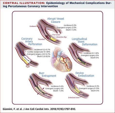 complications of percutaneous coronary interventi