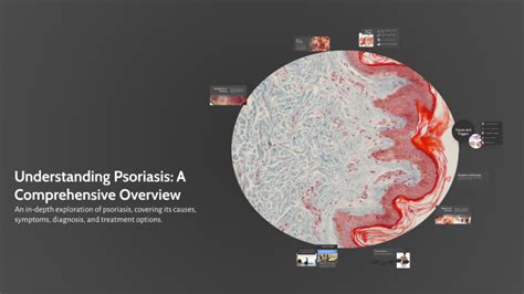 Comprehensive Overview Of Psoriasis