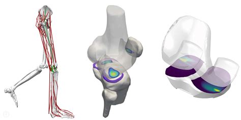Computational Biomechanics