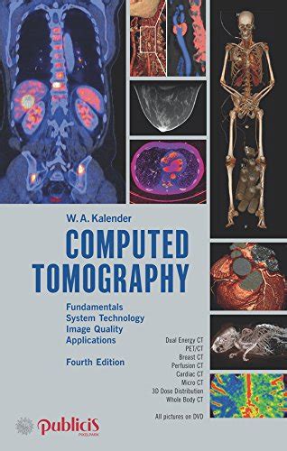 Download Computed Tomography Fundamentals System Technology Image 