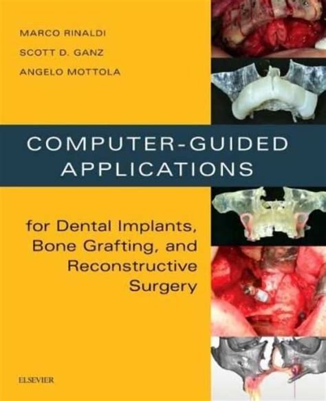 Computer Guided Applications For Dental Implants Bone Grafting And Reconstructive Surgery Adapted Translation 1e