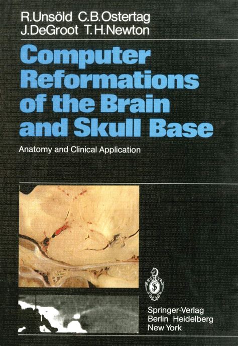 Computer Reformations Of The Brain And Skull