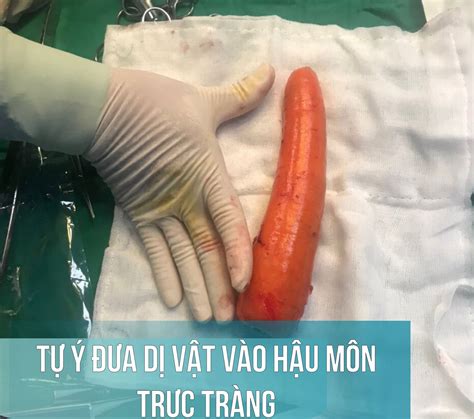 con cặc | Kch thc cu nh bao nhiu l