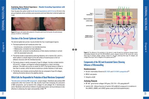 Full Download Concise Guide To Skin Needling 