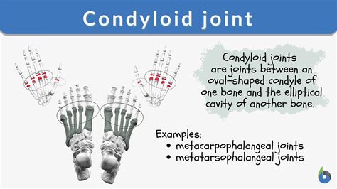 Condyloid