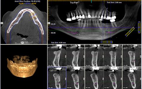 Cone Beam Computed Tomography In Orthodontics Indications Insights And Innovations By Kapila Sunil 2014