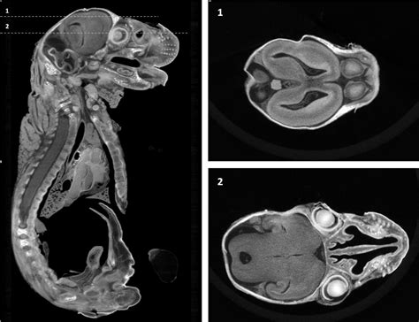 Image related to contrast-resolution-ct