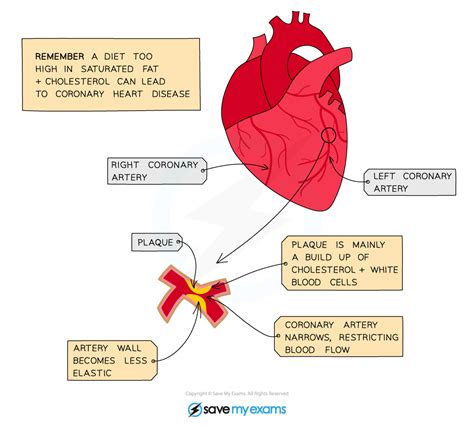Coronary Heart Disease New Gcse Teaching Resources Heart Disease Worksheet - Heart Disease Worksheet
