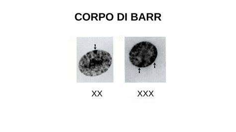 Corpi Di Barr