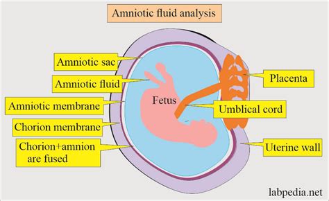 Correlation Analysis Between The Amniotic Fluid Contamination And 3  Grade - 3% Grade