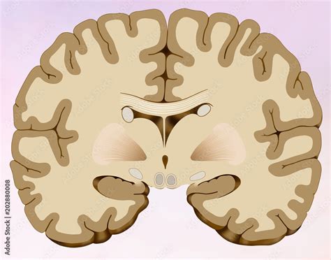 Corte Coronal Del Cerebro