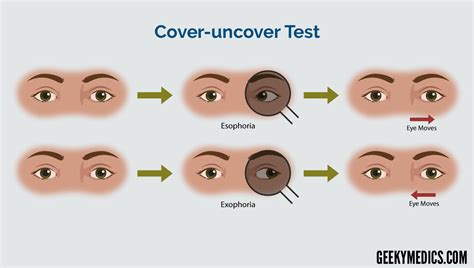 Cover Uncover Test