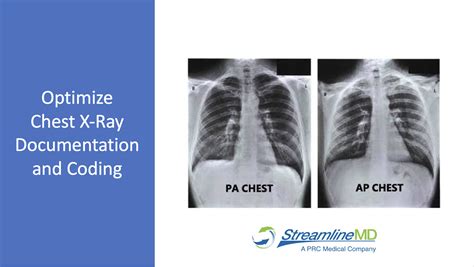 Cpt Code For Chest X Ray