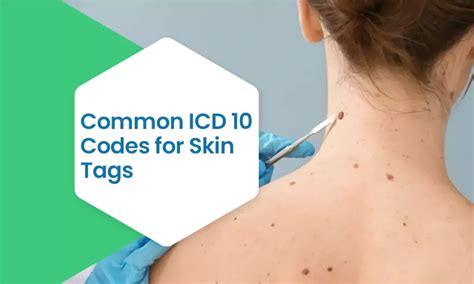 Cpt Code For Skin Tag Removal