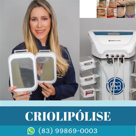 criolipólise-1
