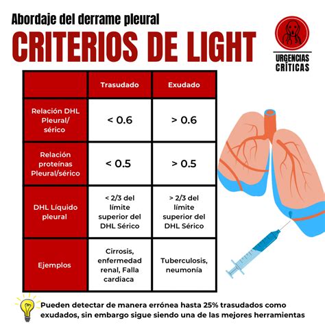 Critérios De Light