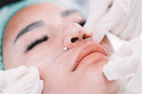 cuping | JEN Cupping Cuping Cup Thn thin vi