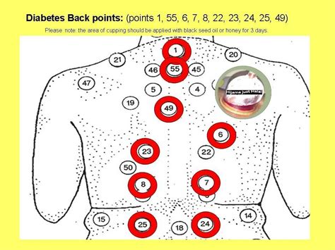 Cupping Points Chart Pdf
