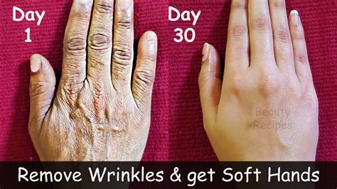Cure For Wrinkled Hands