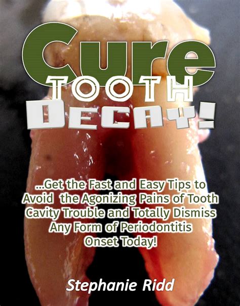 Cure Tooth Decay Fast How To Heal And Prevent Cav