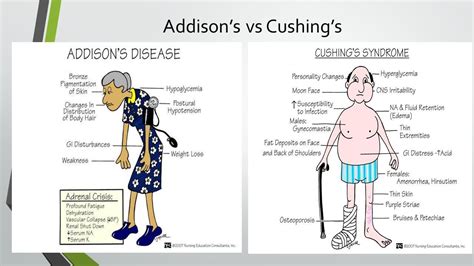 Cushing's Vs Addison's