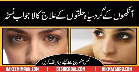 dark circles remove tips in urdu