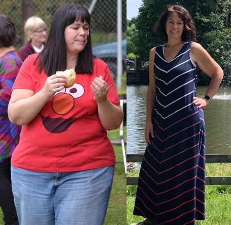 dating after weight loss surgery pictures