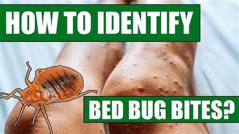 dating someone with bed bugs pictures