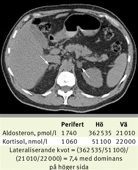 datortomografi buk vad ser man