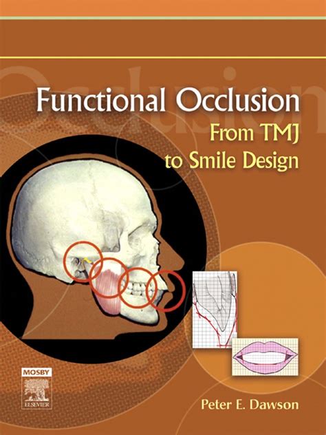 Dawson Occlusion Book