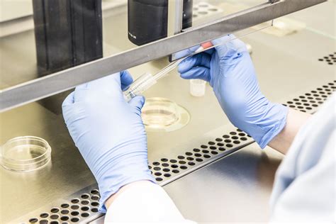 definitie eicelpunctie