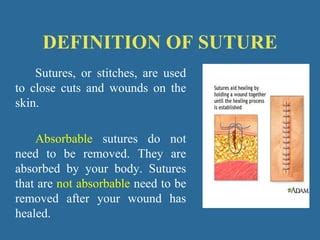 Definition Of A Suture